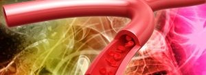 Vascular Surgery