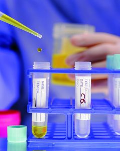 Treatment of bladder cancer in Germany
